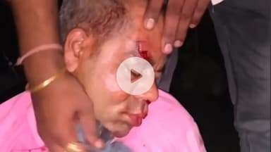 कप्तानगंज: रामकोला में बड़ा हादसा, सांड से टकराई बुलेट, दो लोग घायल, एक की हालत गंभीर, अस्पताल में उपचार जारी