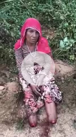 दुखद घटना - 😢 एक महिला (कमला देवी शीतोड) बामनवास  के दोनों पैर काट दिए गए और पैरों से चांदी के आभूषण ले गए