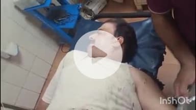 कोल: शाहजमाल में स्कूटी सवार भाजपा अल्पसंख्यक नेता पर एसिड अटैक, मेडिकल कॉलेज में भर्ती, आरोपी पुलिस हिरासत में