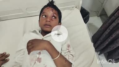 भीलवाड़ा: गिरडिया में खेत जा रहे मां-बेटे पर सियार ने किया हमला, हमले में मां-बेटा गंभीर घायल