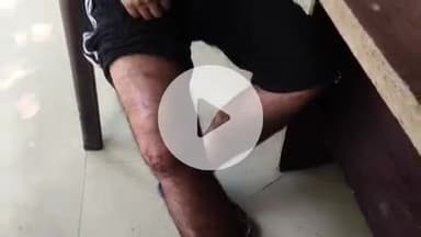 पट्टी: सलाहपुर गांव में पाही पर सो रहे युवक पर हुआ जानलेवा हमला