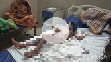 बहराइच: तेलियनपुरवा में बालिका पर अचानक पलटी कड़ाही, बालिका झुलसी, वह नाना के यहां घूमने आई थी