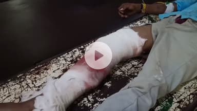 लाडपुरा: सड़क हादसे में गंभीर रूप से घायल युवक कोटा के मेडिकल कॉलेज अस्पताल में भर्ती, उपचार जारी, पुलिस मामले की जांच में जुटी