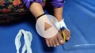 हाथरस: गांव पुसैनी में घर पर खेल रही 3 वर्षीय मासूम बच्ची के पैर पर कोबरा सांप ने काटा, हालत बिगड़ने पर परिजन उसे अस्पताल लाए