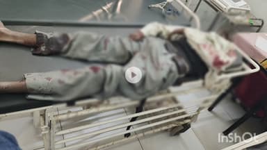 भीलवाड़ा: लांबिया टॉल के समीप तेज रफ्तार ट्रक ने बाइक को मारी टक्कर, हादसे में बाइक सवार की मौत, तीन गंभीर घायल