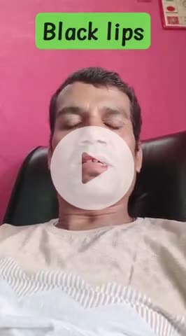 Blacklips remove in few steps #blacklips #blacklipgloss #blacklipsmark #BlackLipstick #almondoil #c
 @blacklips