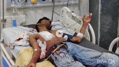 भीलवाड़ा: पुलिस लाइन क्षेत्र में दोस्त ने नाबालिग दोस्त पर चाकू से ताबड़तोड़ हमला किया, उदयपुर में इलाज के दौरान तोड़ा दम