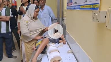 शाहबाद: महमंद में आरा मशीन के बाइक सवार ने बालक को टक्कर मारी, पैर टूटा, जिला अस्पताल रेफर