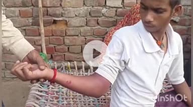 खेरागढ़: साप ने 13 वर्षीय बालक को सोते समय काटा, बायगीरों ने उपचार कर बचाई जान