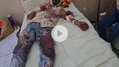 लाडपुरा: खटकड़ नेनवा मार्ग पर मोटरसाइकिल को अज्ञात वाहन ने मारी टक्कर, युवक गंभीर घायल, एमबीएस अस्पताल में भर्ती, उपचार जारी