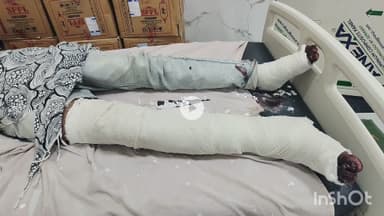 भीलवाड़ा: मांडलगढ़ में ट्रेलर चालक ने अचानक साइड दबाई, पीछे आ रहा बाइक सवार अनियंत्रित होकर गिरा और गंभीर घायल हुआ