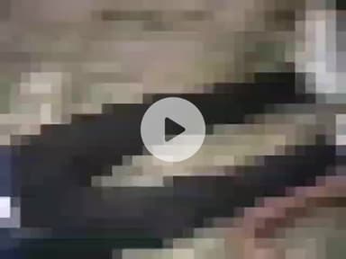 धनौरा: गजरौला मंडी धनौरा रोड पर तेज रफ्तार रोडवेज बस की टक्कर से बाइक सवार तीन युवक घायल, हालत गंभीर