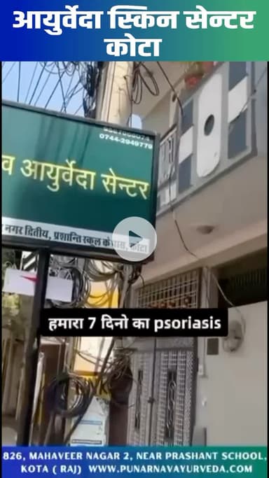 Psoriasis treatment in kota