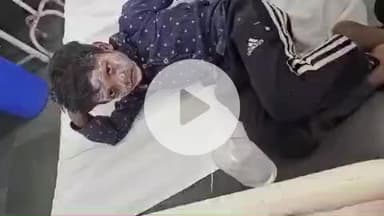 बाह: दीपावली की रात बाह क्षेत्र में पटाखों से 4 बच्चे झुलसे, प्रशासन ने की सावधानी बरतने की अपील