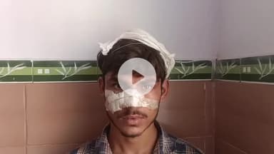 रामपुर: गबनपुरा गांव में पटाखा फोड़ने के विवाद में चार लोगों ने एक युवक की चाकू से नाक काटी, पुलिस ने शुरू की जांच