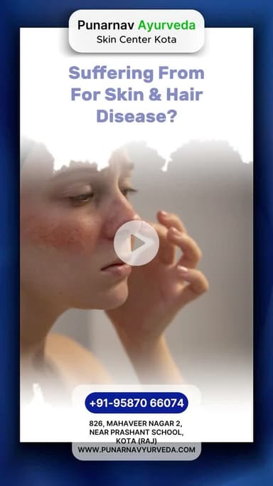 Ayurveda skin hospital kota