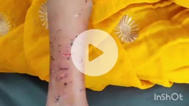 ब्यौहारी: ब्यौहारी अस्पताल में घायल महिला का इलाज जारी, पारिवारिक विवाद में हुई मारपीट