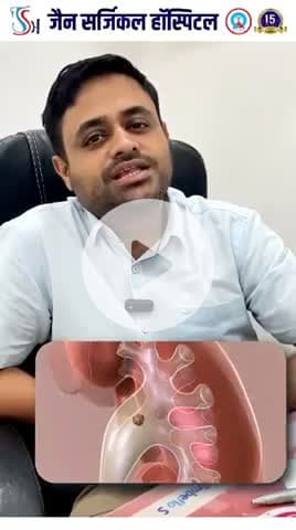 Video- 1 - Myth Fact Series- 
वीडियो १ - ब्रह्म या सच्चाई ।

क्या बियर पीने से किडनी स्टोन निकल जाता है ।
 # Beer and kidney stone
# No to Alchohol