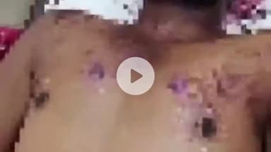 देेेवरिया: मईल थाना क्षेत्र के पनिका बाजार में जेवर मांगने गई महिला पर सर्राफा व्यापारी ने फेंका तेजाब, चार लोग झुलसे