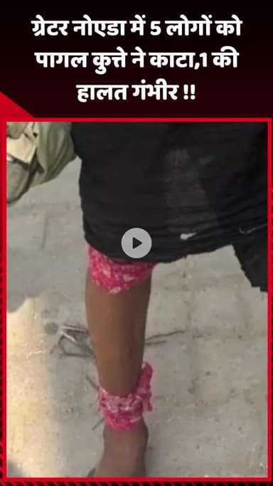 गौतम बुद्ध नगर: ग्रेटर नोएडा में 5 लोगों को पागल कुत्ते ने काटा, एक की हालत गंभीर