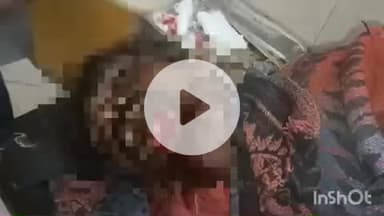 बहराइच: सुसरौली इलाके में पिता ने बेटों से काम करने के लिए कहा, तो बेटों ने पिता की जमकर पिटाई की, पिता घायल