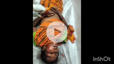 सिसई: बसिया रोड में लाकेया मोड़ के पास दो मोटरसाइकिल की टक्कर में चार लोग घायल