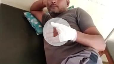 पट्टी: तरदहा गांव में पटाखा फोड़ते समय युवक घायल, अस्पताल में चल रहा है इलाज