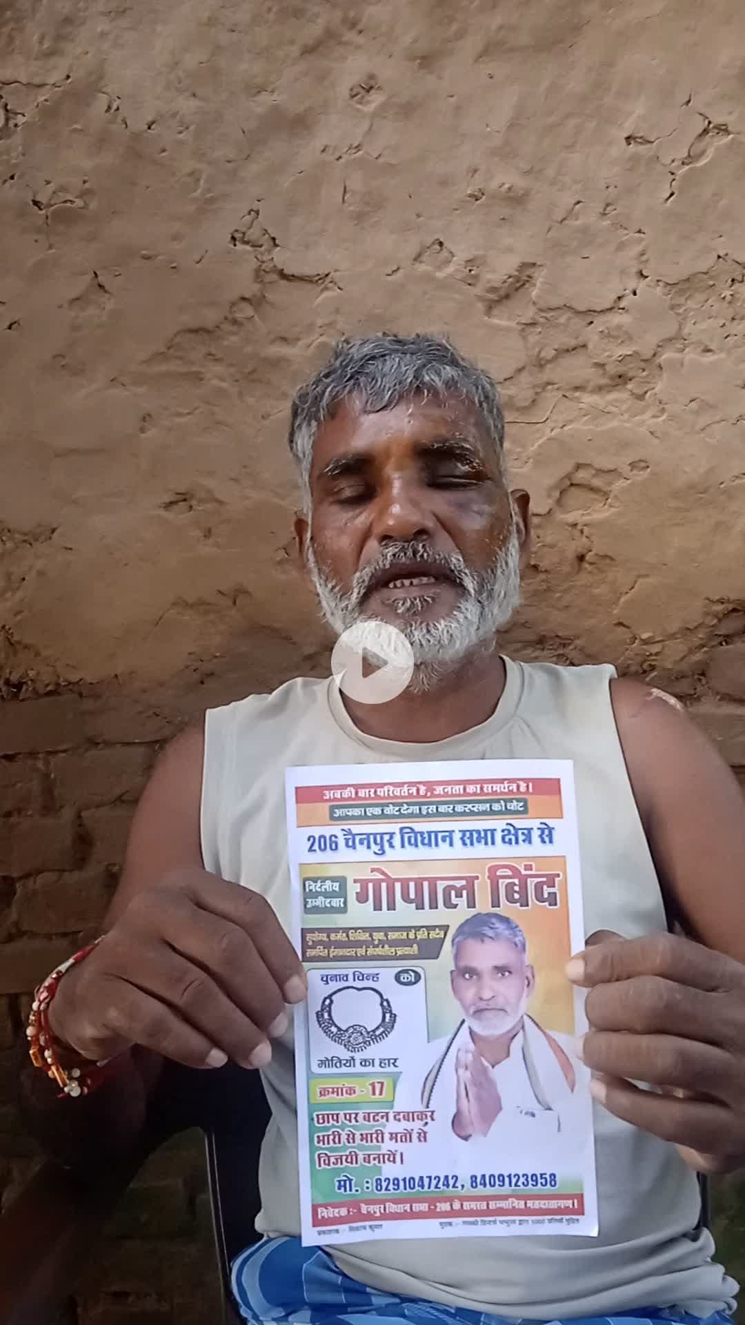 गोपाल बिंद निर्दलीय विधायक प्रत्याशी बाइक का चक्का फिसल जाने के कारण #चोट आने के करण घूमने फिरने मे असमर्थ हो गये है