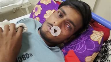 बिचौली हप्सी: इंदौर: कार्बाइड गन से नौ लोगों की आंखों पर असर, 8 मरीज़ डिस्चार्ज, एक का इलाज जारी
