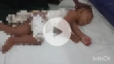 बहराइच: बेलासपुरवा में कढ़ाई का खौलता पानी गिरने से बालक झुलसा, आलू उबालने की हो रही थी तैयारी