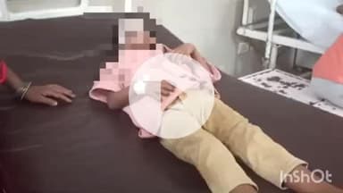 बहराइच: सुदर्शन जोत में पटाखा जलाते समय 6 वर्षीय बालक झुलस गया, इलाज जारी