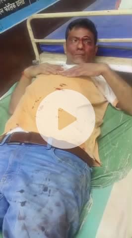 बदायूं: #बिसौली से तहसील पर रोड पर आमने-सम टकराई गाड़ी जिसमें प्रमोद सक्सेना के आई गंभीर रूप से चोट  आई #up360 #update #news #up