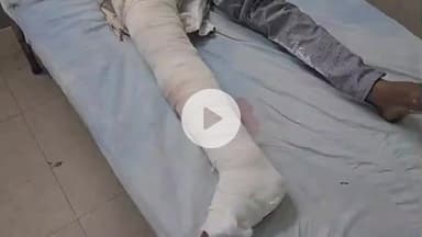 पीपलदा: स्टेट हाईवे 70 पर गणेशगंज गांव के निकट दो मोटरसाइकिलों की टक्कर में एक युवक हुआ घायल, एमबीएस अस्पताल में कराया गया भर्ती