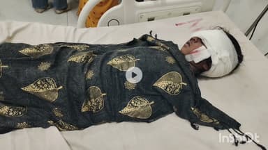 भीलवाड़ा: महुआ में ननिहाल के बाहर खेल रहे 5 वर्षीय बालक पर श्वान ने हमला किया, चेहरा नोचकर लहूलुहान किया