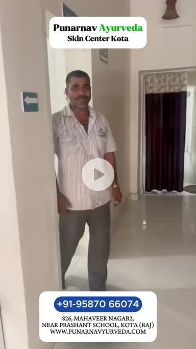 सोरायसिस का इलाज आयुर्वेद से