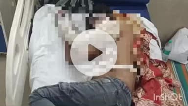 बहराइच: गिलौला में वेल्डिंग करते समय युवक के कपड़ों में लगी आग, युवक झुलसा, इलाज जारी