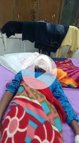 अलवर: अखैपुरा में 10 साल के बालक के हाथ में सुतली बम फटा, बारूद के कारण दोनों आंखें झुलसी