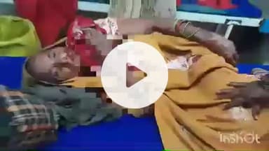 हाथरस: गांव चार्चपुर भटेला में घर पर वृद्ध महिला पर आवारा कुत्ते ने किया हमला, जबड़े को नोचकर किया घायल, अस्पताल से आगरा रेफर