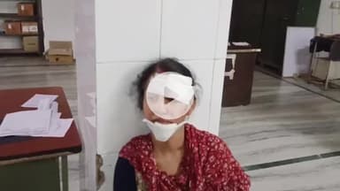 लाडपुरा: कोटा में निजी बस पलटी, बाड़मेर से कोटा आ रही थी, ट्रोले को ओवरटेक करने पर हुआ हादसा, 13 यात्री घायल