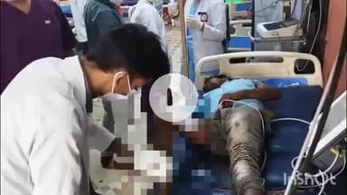 हरदोई: सांडी मार्ग पर मेढू गांव के पास बिजली के खंभे पर चढ़कर तार जोड़ते समय लाइनमैन को लगा करंट, गंभीर रूप से झुलसा, लखनऊ रेफर