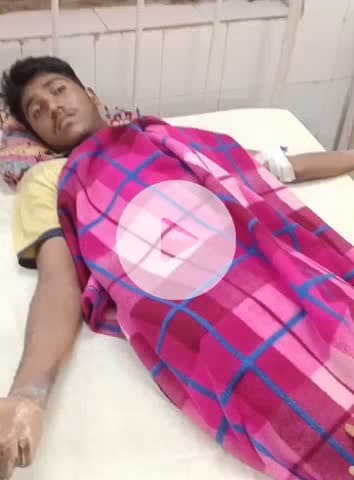 अलवर: मेहताब सिंह का नोहरा निवासी किशोर के हाथ में फटा अनार बम, दोनों हाथ झुलसे, चचेरे भाई की शादी में पटाखे लाया था