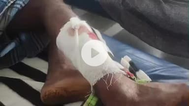 அஞ்செட்டி: லட்சுமிபுரத்தில் ராகி தோட்டத்திற்கு இரவு காவலுக்கு சென்றவரை காட்டுப்பன்றி தாக்கியதில் அவர் ஓசூர் அரசு மருத்துவமனையில் படுதான் எங்களுடன் அனுமதி