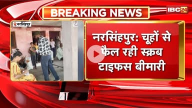 Narsinghpur News : चूहों से फैल रही स्क्रब टाइफस बीमारी। 3 लोग हुए संक्रमण का शिकार