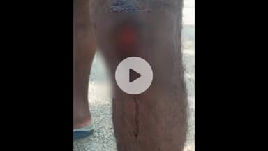 കുന്നംകുളം: കുന്നംകുളം സെൻ്റ് ഗ്രിഗോറിയോസ് ഓർത്തഡോക്സ് പള്ളി പെരുന്നാളിനിടെ യുവാക്കളെ പോലീസ് മർദ്ദിച്ചതായി പരാതി