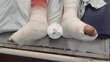 लाडपुरा: कोटा में पोस्टर फाड़ने के विवाद में पिता-पुत्र को लाठियों से मारा, ट्रैक्टर लगाकर कार से पीछे से टक्कर मारी