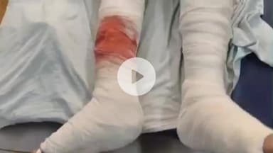 दीगोद: निमोदा हरिजी गांव में पुरानी रंजिश में पिता-पुत्र पर धारदार हथियारों से हमला, दोनों गंभीर घायल