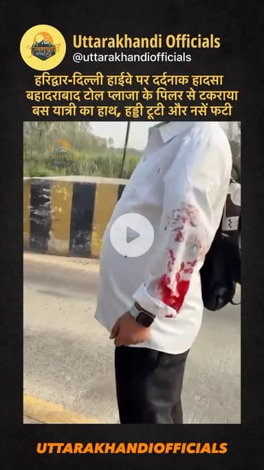 हरिद्वार-दिल्ली हाईवे पर दर्दनाक हादसा  बहादराबाद टोल प्लाजा के पिलर से टकराया बस यात्री का हाथ, हड्डी टूटी और नसें फटी