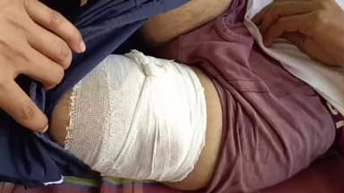 लाडपुरा: जमीतपुरा में खूनखराबा: पुराने पार्टनर ने अकेला काम शुरू किया, गैंग ने चाकूओं से किया हमला, कोटा में भर्ती उपचार जारी