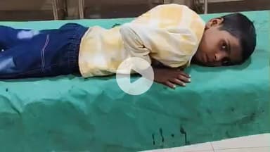 पडरौना: जटहा बाजार में पागल कुत्ते का आतंक, कई लोग घायल, मासूम नीरज समेत सभी का जिला अस्पताल में इलाज जारी