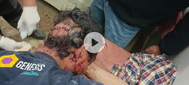 घाट: नंदानगर विकासखंड के सीक गांव में भालू के हमले से चारवाहक गंभीर घायल, श्रीनगर चिकित्सालय में भर्ती